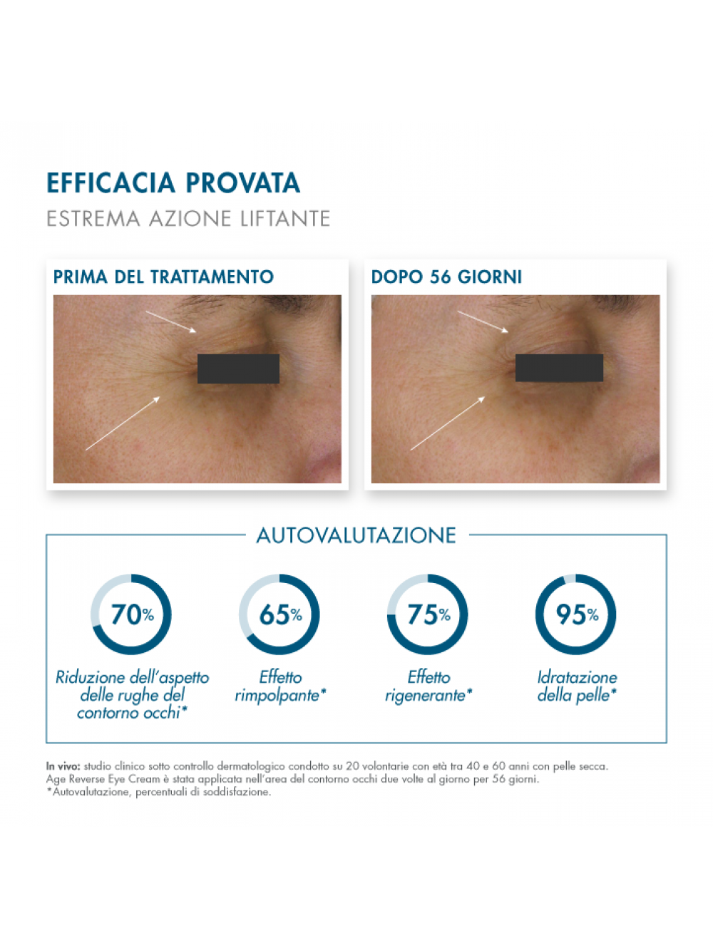 eye-cream-1