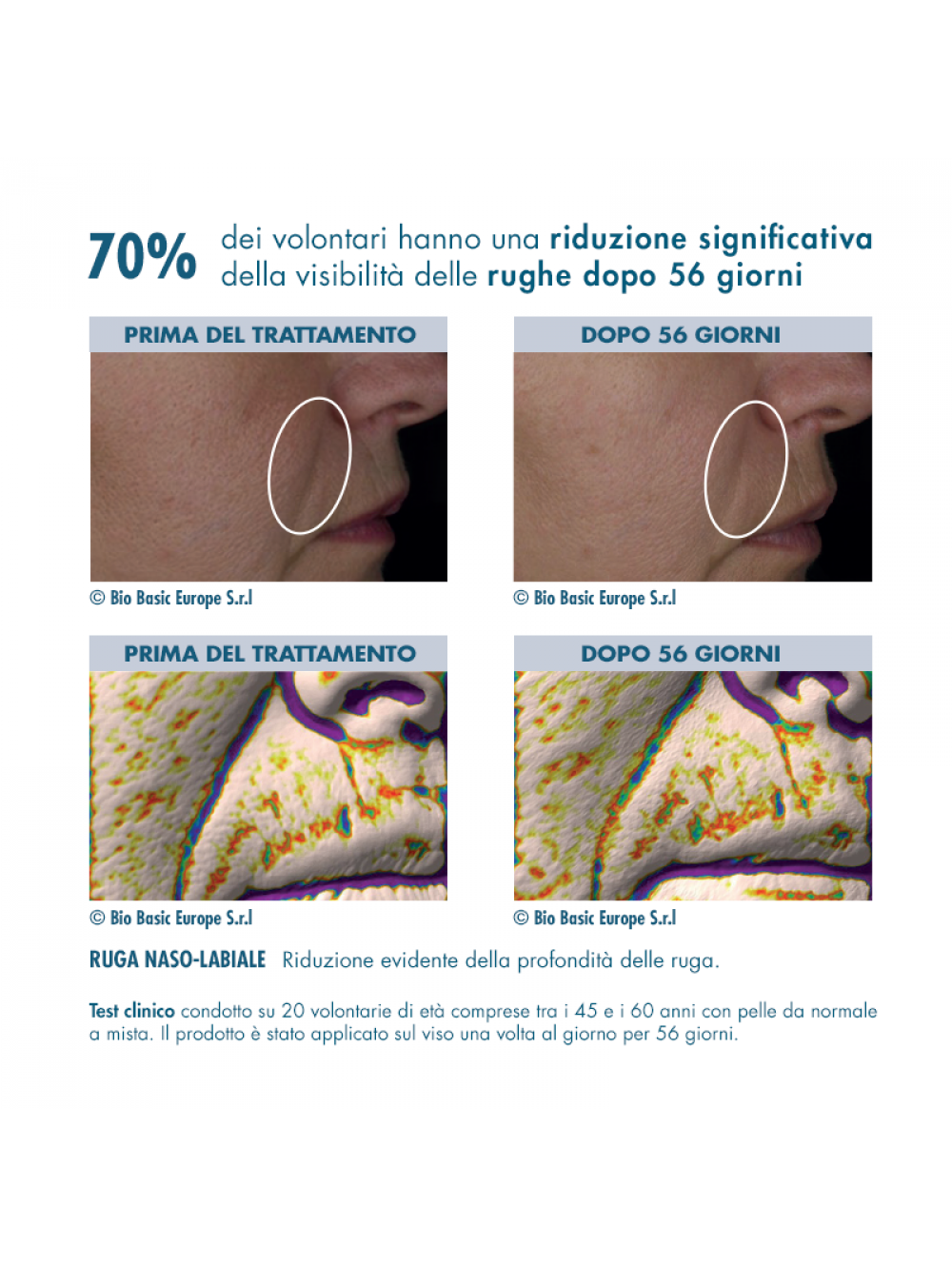 retinol-cream-prima-dopo-1