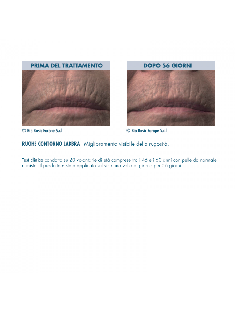 retinol-cream-prima-dopo-2